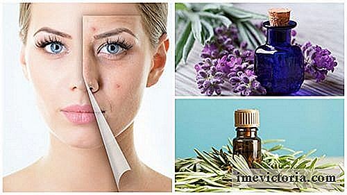 Curățați-vă fața de acnee cu aceste 6 uleiuri esențiale minunate