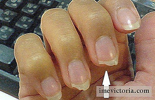 Hur man undviker sköra naglar