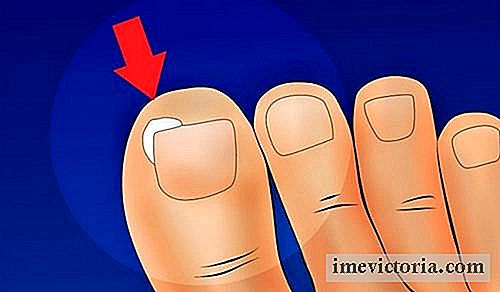 Cum de a preveni unghiile noastre incarnata