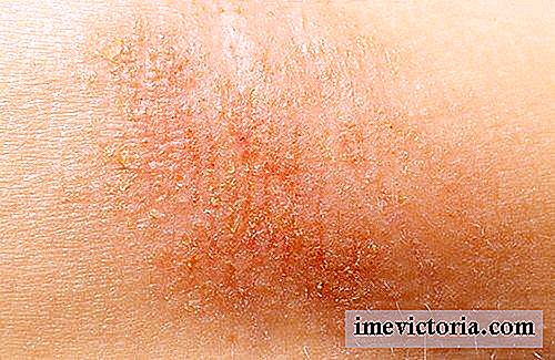 Naturläkemedel för behandling av torr hud
