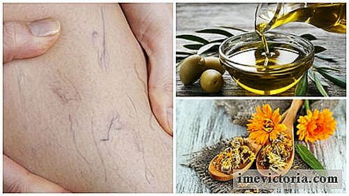Ridurre le vene varicose con questo trattamento a base di olio d'oliva e di Calendula