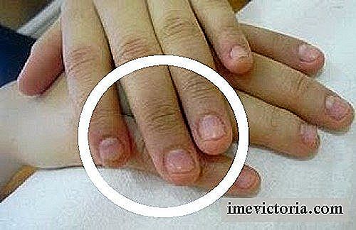 Sfaturi pentru a evita roaderea unghiilor