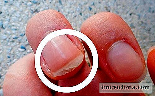 Waarom splitsen nagels? De oorzaken, behandelingen en oplossingen