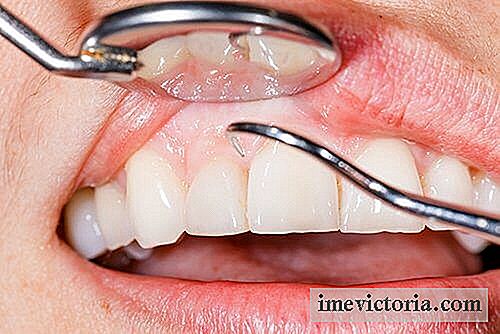 14 Grunde til, at du har blødende tandkød