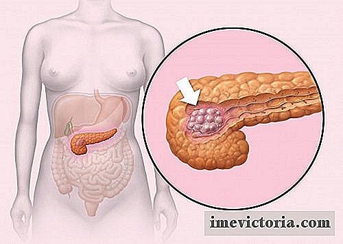 5 Early Signs for Cancer al pancreas