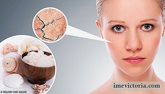 5 Naturlige midler til fuldstændig behandling af tør hud
