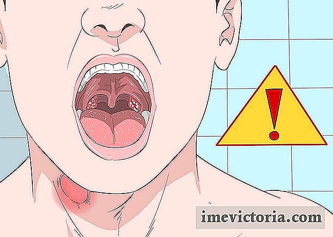 5 Semne posibile de noduli în gât