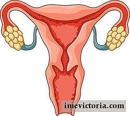 6 Tekenen die detecteren ovarium syndroom Polycysteus