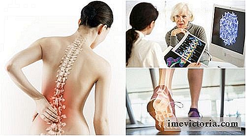 6 Ting å vite om osteoporose