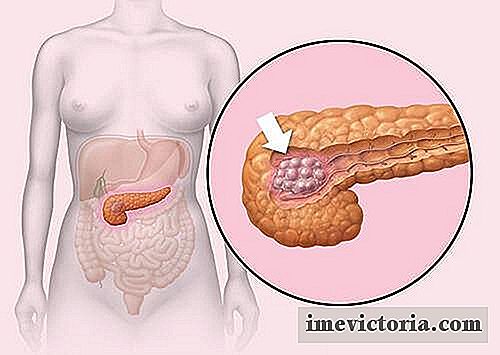 Putem preveni cancerul pancreatic?