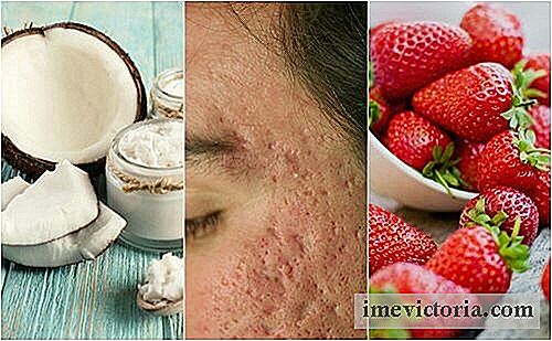 Cum de a atenua cicatricile acnee cu 5 tratamente acasă