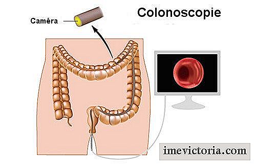 Cum de a detecta cancerul de colon timp
