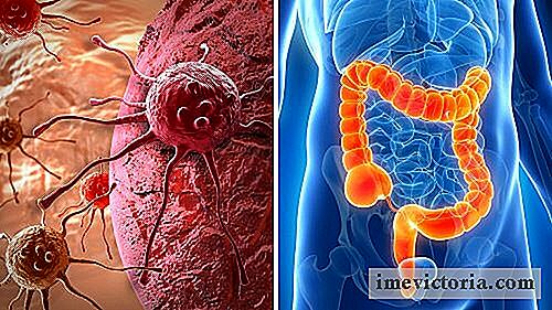 Cum de a detecta posibile simptome ale cancerului de colon?