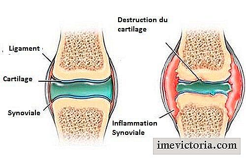 Cum de a preveni durerea în cartilaj