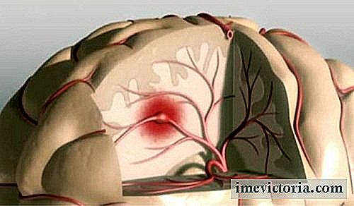 Măsuri preventive de prevenire a unui accident vascular cerebral