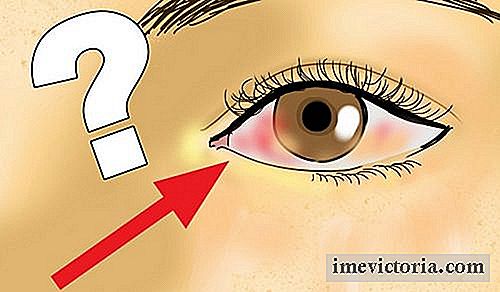 Retinal detachement: definition, orsaker och förebyggande