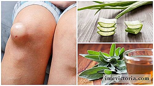 5 De beste anti-inflammatoire middelen aan de knie zwellen