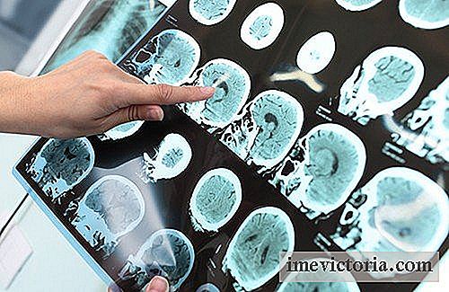 Můžeme prevenci Alzheimerovy nemoci?