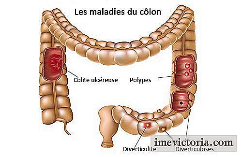 Cómo prevenir enfermedades comunes del colon