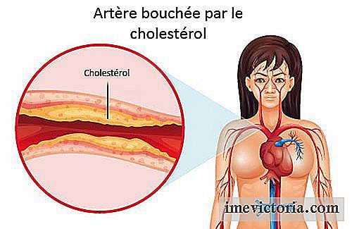Vad man ska göra för att kontrollera kolesterol