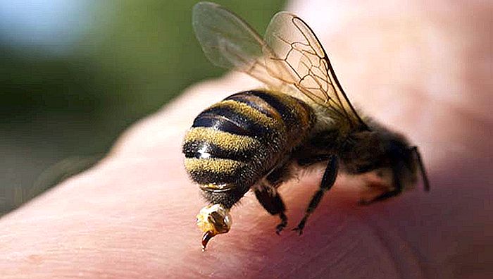 Rübe und Biene STING - Symptome und Behandlung
