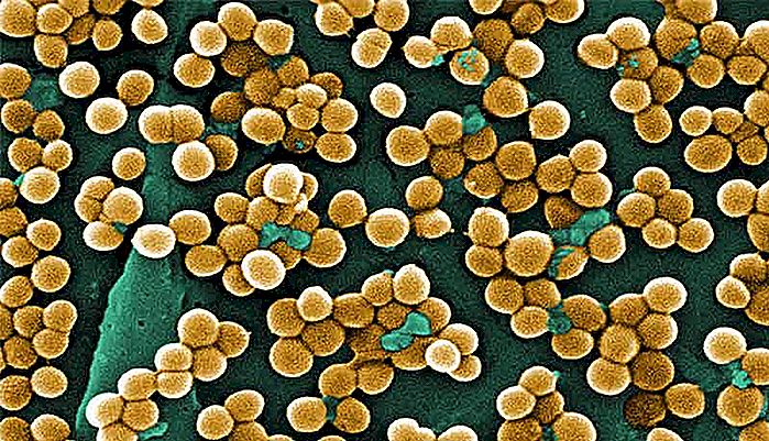STAPHYLOCOCCUS AUREUS - Hvad er risikoen ved denne bakterie?