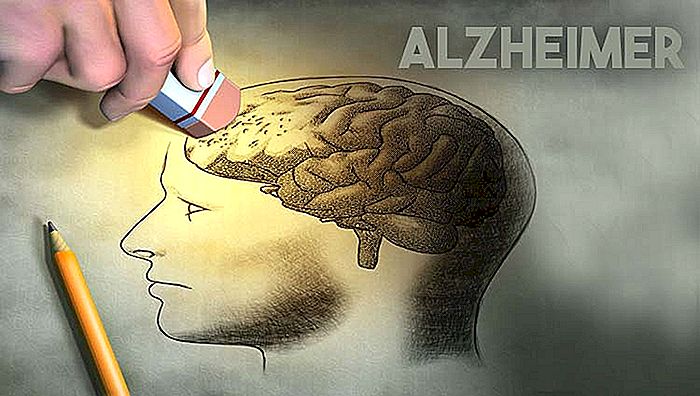 ALZHEIMER'S ZIEKTE - Symptomen, oorzaken en behandeling