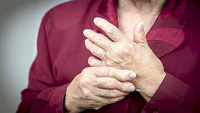 Reumatoïde artritis - Symptomen, oorzaken en behandeling
