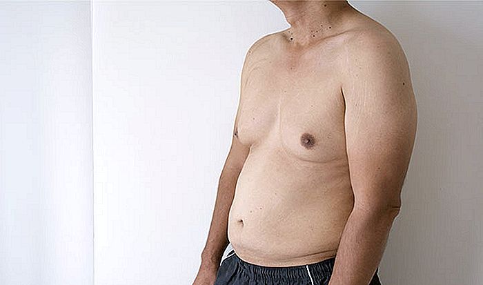GINECOMASTIA - Mannlig bryst