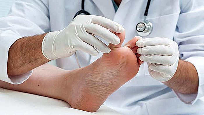 FRIEIRA - ATHLETE FOOT - Ursachen, Symptome und Abhilfen