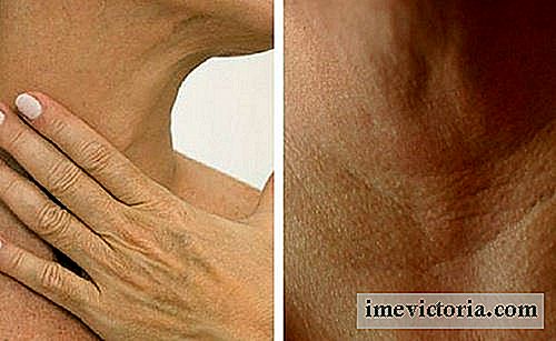 4 Naturliga behandlingar för att förhindra utseende av rynkor i nacken och i händerna.