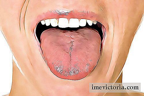 6 Hjemme rettsmidler for å behandle canker sår på tungen