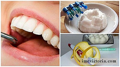 6 Punte di casa per rimuovere il tartaro accumulato sui denti