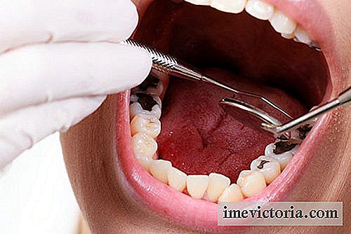 6 Naturlig rettsmidler for å kjempe mot hull i tennene
