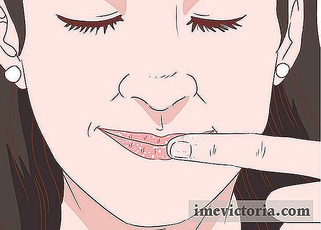 6 Tips om gesprongen lippen te elimineren