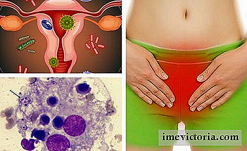 6 Tips for å lindre vaginal infeksjon forårsaket av soppinfeksjoner