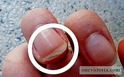 7 Home behandlingar för att stärka sköra naglar