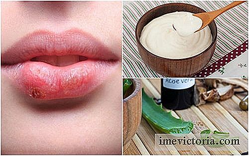 7 Tratamente naturale pentru a combate herpes labial