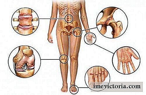 8 Piante per ridurre il dolore da artrite
