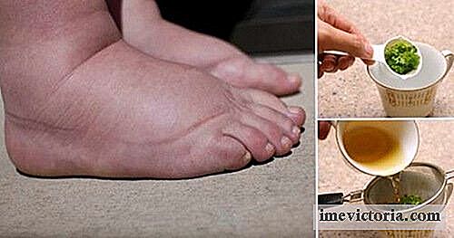 Een uitzonderlijke remedie met peterselie om gezwollen voeten te verlichten