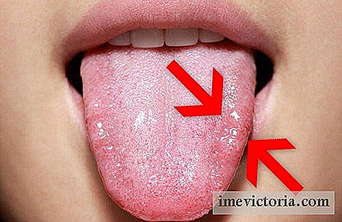 Hjem Remedies for oral candidiasis