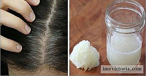 Hem Behandling lök och honung för att bekämpa håravfall