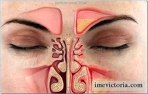 Come rimuovere la congestione nasale in meno di un minuto