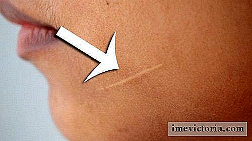 Cum de a elimina cicatrici ale pielii?