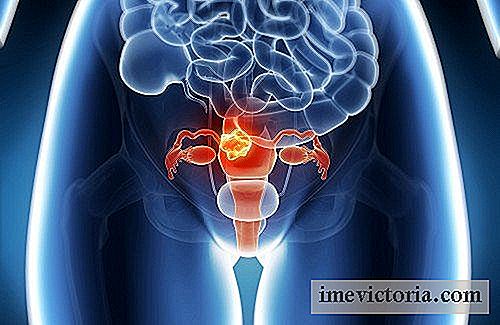 Hoe endometriose op een natuurlijke manier te verlichten
