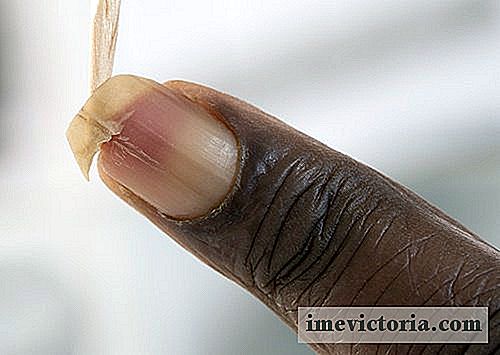 Hur kan man stärka sköra naglar?