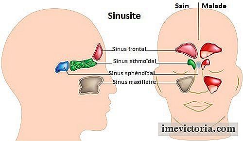 Genezing van de sinusitis van nature