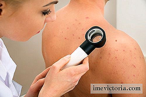 Natuurlijke remedies om acne op de borst, schouders en rug te elimineren