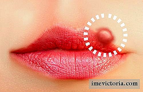 Natürliche Lösungen gegen Lippenherpes