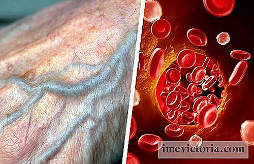 Natural Tips for å bedre blodtilførselen